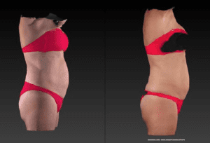 red light therapy weight loss before and after: 2 images of the same woman placed side by side in a red bathing suit to show fat loss around her stomach.