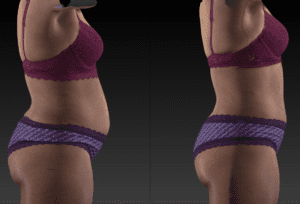 2 Images of a woman in her underwear from shoulders to thighs to show the inches of belly fat lost from red light therapy.