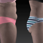 Fat loss before and after red light therapy: 2 Images of a woman, one in pink underwear and one in blue striped underwear to show the reduction of fat in her midsection.