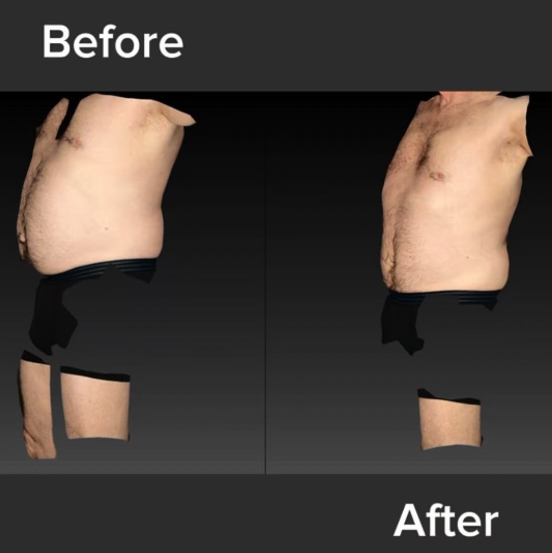 Patient Gary's before and after results after a 6 session RLT with Contours